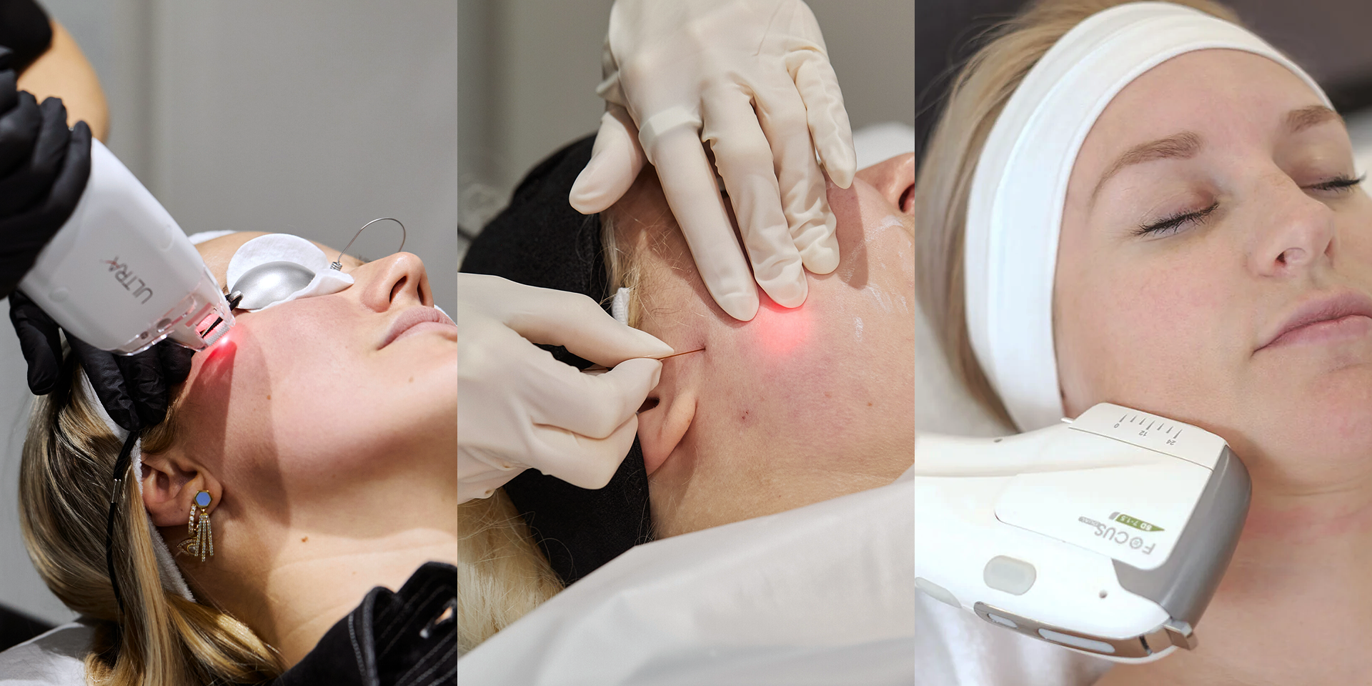 Autumn Advantage: Laser Treatments You Can’t Miss