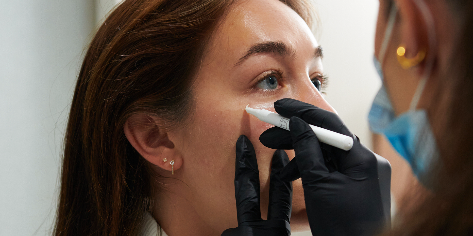 Non-Surgical Facelifts – How They Work & What to Expect