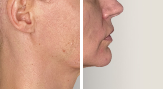 JULAINE_Before_After_1.png