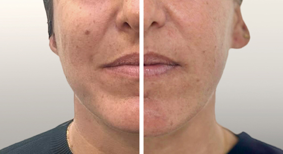 JULAINE_Before_After_2.png
