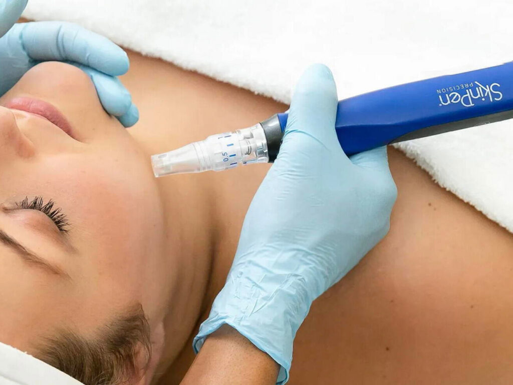 Skin Tightening Innovations 2025: Non-Surgical Lifting for Face