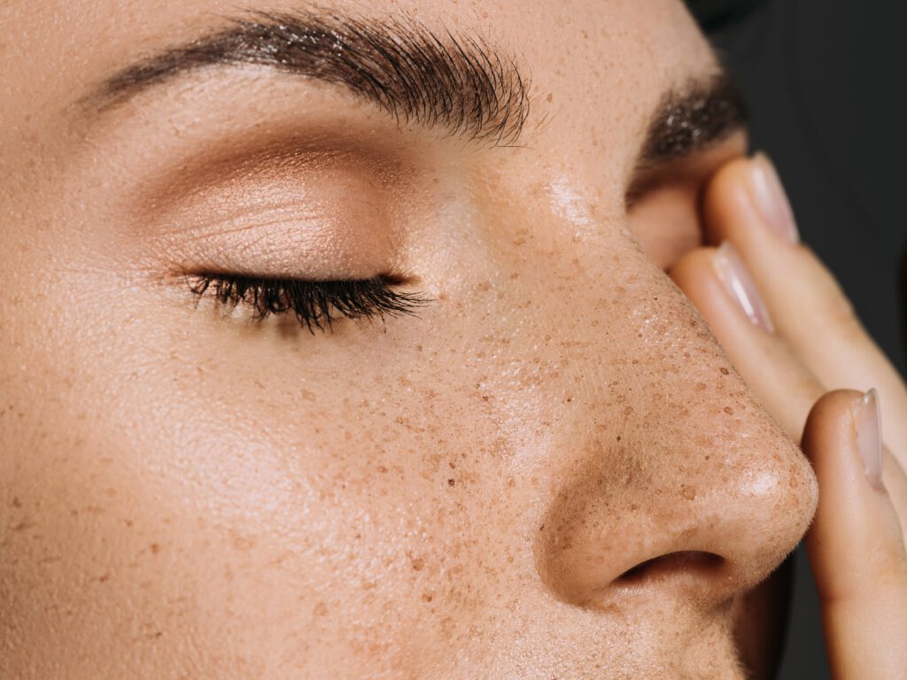 A close-up side view of a person’s face with eyes closed, showing skin texture and freckles across the nose and cheeks.