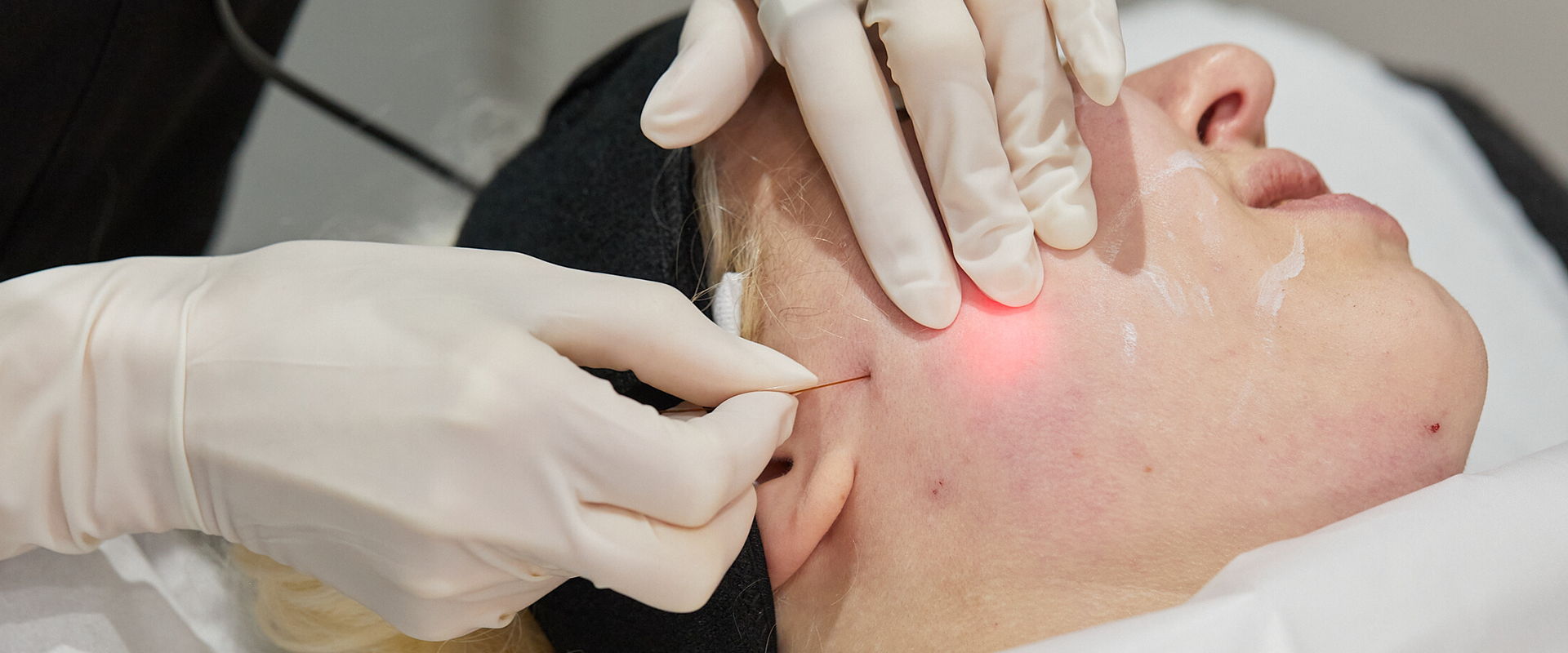 Non Surgical Blog 3 — Facial Sculpting London