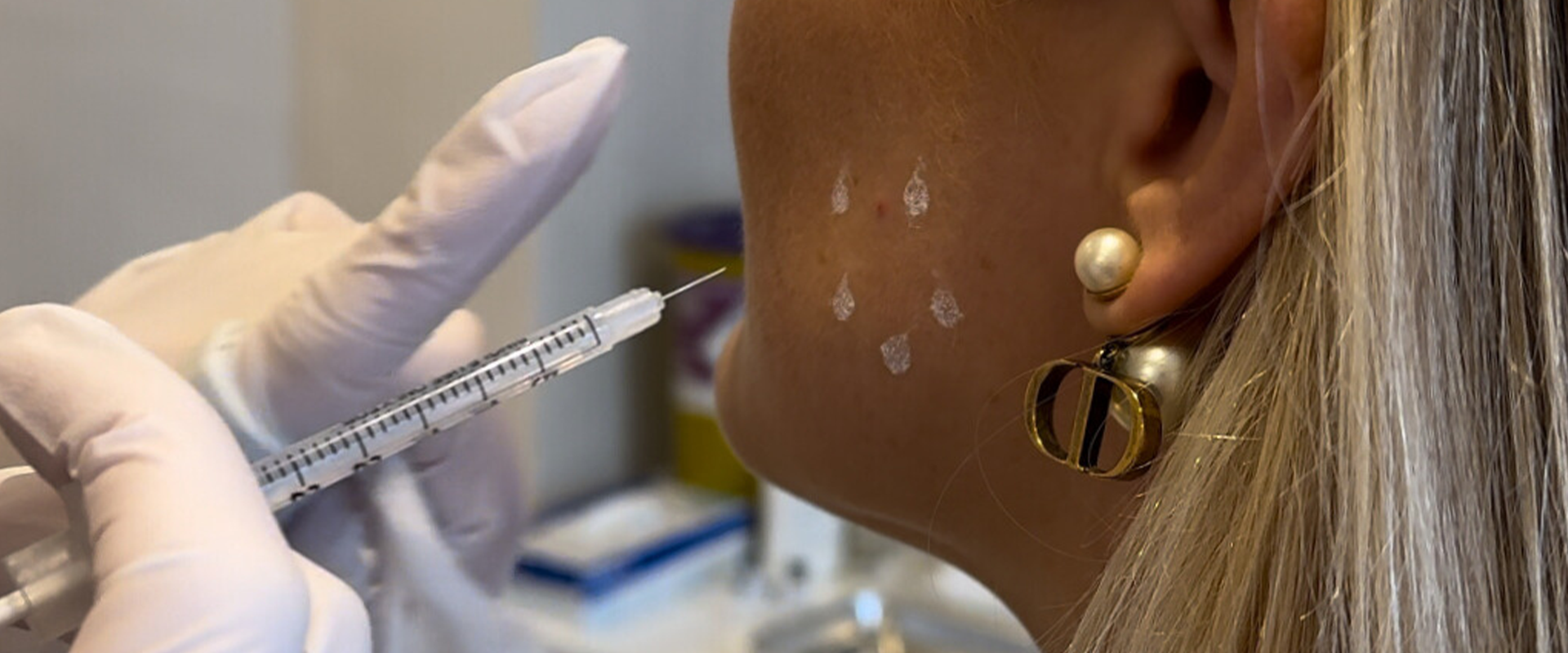 Non Surgical Blog 5 — Facial Sculpting London